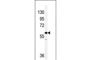 Western Blotting (WB) image for anti-Vimentin (VIM) (AA 430-457), (C-Term) antibody (ABIN389212)