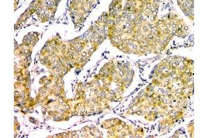 IHC analysis of GM130 using anti-GM130 antibody (ABIN6719433). (Golgin A2 (GOLGA2) (AA 796-913) 抗体)