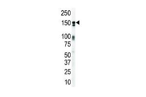 Western blot analysis of anti-ErbB3 Pab (ABIN391949 and ABIN2841747) in mouse brain lysate. (ERBB3 抗体  (N-Term))