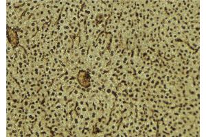 ABIN6279623 at 1/100 staining Mouse liver tissue by IHC-P. (NUP88 抗体  (Internal Region))