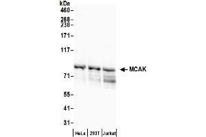 Western Blotting (WB) image for anti-Kinesin Family Member 2C (KIF2C) (AA 550-600) antibody (ABIN7451864)