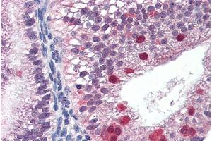 Immunohistochemistry (IHC) image for anti-Fanconi Anemia Complementation Group G (FANCG) (C-Term) antibody (ABIN190919)