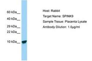 Image no. 1 for anti-Serine Peptidase Inhibitor, Kazal Type 9 (SPINK9) (C-Term) antibody (ABIN6750139) (SPINK9 抗体  (C-Term))