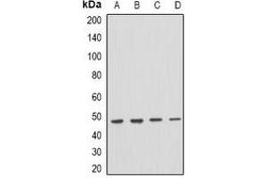 Western blot analysis of PSTPIP1 expression in THP1 (A), mouse spleen (B), mouse brain (C), rat brain (D) whole cell lysates. (PSTPIP1 抗体)