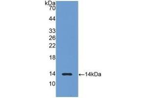 Detection of Recombinant LHb, Rat using Polyclonal Antibody to Luteinizing Hormone Beta Polypeptide (LHb) (LHB 抗体  (AA 21-141))