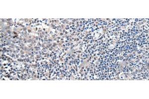 Immunohistochemistry of paraffin-embedded Human tonsil tissue using ZBTB10 Polyclonal Antibody at dilution of 1:100(x200) (ZBTB10 抗体)