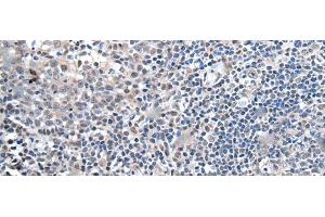 Immunohistochemistry of paraffin-embedded Human tonsil tissue using ZBTB10 Polyclonal Antibody at dilution of 1:100(x200)