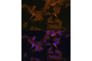 Immunofluorescence analysis of C6 cells using EIF2B2 antibody (ABIN6132131, ABIN6140037, ABIN6140038 and ABIN6222805) at dilution of 1:100.