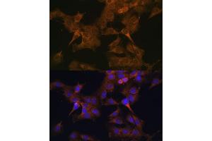 Immunofluorescence analysis of C6 cells using EIF2B2 antibody (ABIN6132131, ABIN6140037, ABIN6140038 and ABIN6222805) at dilution of 1:100. (EIF2B2 抗体  (AA 1-351))