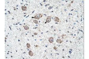Image no. 1 for anti-Kelch-Like 25 (KLHL25) (AA 163-212) antibody (ABIN203314) (KLHL25 抗体  (AA 163-212))
