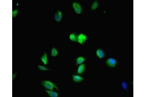Immunofluorescent analysis of Hela cells using ABIN7159120 at dilution of 1:100 and Alexa Fluor 488-congugated AffiniPure Goat Anti-Rabbit IgG(H+L) (MED29 抗体  (AA 1-212))