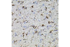 Immunohistochemistry (IHC) image for anti-Transient Receptor Potential Cation Channel, Subfamily A, Member 1 (TRPA1) (AA 850-950) antibody (ABIN6149565)