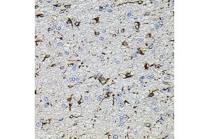 Immunohistochemistry of paraffin-embedded rat brain using TRP antibody (ABIN6133559, ABIN6149565, ABIN6149567 and ABIN6224668) at dilution of 1:100 (40x lens). (TRPA1 抗体  (AA 850-950))
