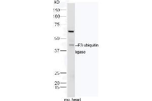 Mouse heart lysates probed with Rabbit Anti-E3 ubiquitin ligase Polyclonal Antibody, Unconjugated  at 1:5000 for 90 min at 37˚C. (MUL1 抗体  (AA 45-95))