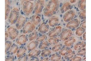 Detection of CTGF in Rat Stomach Tissue using Monoclonal Antibody to Connective Tissue Growth Factor (CTGF) (CTGF 抗体  (AA 25-347))