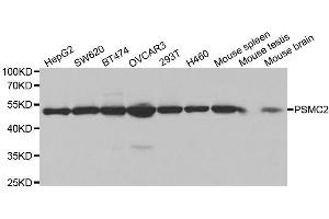Western Blotting (WB) image for anti-Proteasome (Prosome, Macropain) 26S Subunit, ATPase, 2 (PSMC2) (AA 1-160) antibody (ABIN3015801)