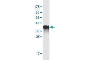 Western Blot detection against Immunogen (35. (Otopetrin 1 抗体  (AA 415-504))