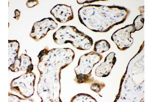 Immunohistochemistry (IHC) image for anti-Nucleotide-Binding Oligomerization Domain Containing 1 (NOD1) (AA 1-160) antibody (ABIN3043890)