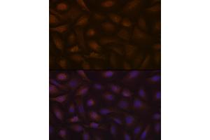 Immunofluorescence analysis of U-2 OS cells using KIF Rabbit mAb (ABIN7268120) at dilution of 1:100 (40x lens). (KIFAP3 抗体)