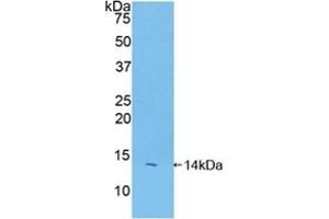 Detection of Recombinant FAM19A2, Mouse using Polyclonal Antibody to Family With Sequence Similarity 19, Member A2 (FAM19A2) (FAM19A2 抗体  (AA 31-119))