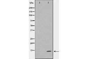 Western blot analysis on HeLa cell lysate using TUSC2 Antibody,The lane on the left is treated with the antigen-specific peptide. (TUSC2 抗体  (Internal Region))