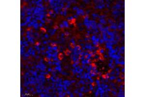 Immunofluorescence (Paraffin-embedded Sections) (IF (p)) image for anti-rho GTPase Activating Protein 18 (ARHGAP18) antibody (ABIN7075417)