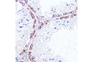 Immunohistochemistry (IHC) image for anti-Signal Sequence Receptor, beta (Translocon-Associated Protein Beta) (SSR2) antibody (ABIN7270299)