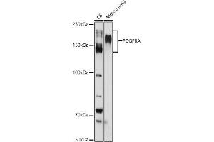 Western blot analysis of extracts of various cell lines, using PDGFRA antibody (ABIN3022920, ABIN3022921, ABIN3022922 and ABIN6219298) at 1:1000 dilution. (PDGFRA 抗体  (AA 1-210))