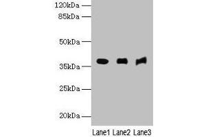 Western blot All lanes: MRNIP antibody at 4 μg/mL Lane 1: Mouse kidney tissue Lane 2: Mouse heart tissue Lane 3: Hela whole cell lysate Secondary Goat polyclonal to rabbit IgG at 1/10000 dilution Predicted band size: 38, 30, 32 kDa Observed band size: 38 kDa (MRN Complex-Interacting Protein (MRNIP) (AA 1-200) 抗体)