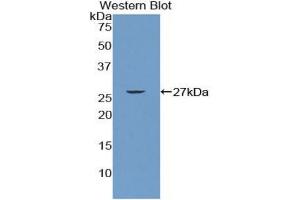 Western blot analysis of the recombinant protein. (CD79b 抗体  (AA 26-225))