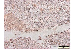 Image no. 1 for anti-Cardiotin antibody (ABIN335361) (Cardiotin 抗体)