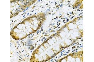 Immunohistochemistry of paraffin-embedded Human colon using PGK1 Polyclonal Antibody at dilution of 1:100 (40x lens).