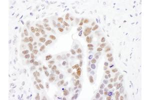 anti-Nicotinamide Nucleotide Adenylyltransferase 1 (NMNAT1) (AA 229-279) antibody