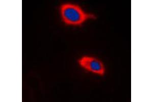 Immunofluorescent analysis of HCCS staining in Raw264. (HCCS 抗体  (Center))