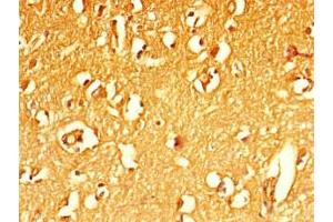 Immunohistochemistry of paraffin-embedded human brain tissue using ABIN7160129 at dilution of 1:100 (MFSD5 抗体  (AA 216-248))