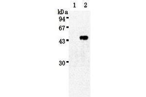 Western Blotting (WB) image for anti-Sialidase 3 (Membrane Sialidase) (Neu3) antibody (ABIN1449196) (Neu3 抗体)