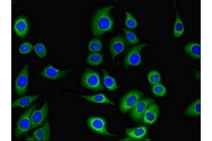 Immunofluorescent analysis of A549 cells using ABIN7146265 at dilution of 1:100 and Alexa Fluor 488-congugated AffiniPure Goat Anti-Rabbit IgG(H+L) (Tescalcin 抗体  (AA 2-214))