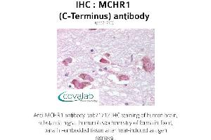 Image no. 1 for anti-Melanin-Concentrating Hormone Receptor 1 (MCHR1) (C-Term) antibody (ABIN1736817) (MCHR1 抗体  (C-Term))