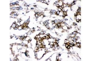IHC analysis of AEBP2 using anti-AEBP2 antibody (ABIN4886435). (AEBP2 抗体  (AA 424-517))