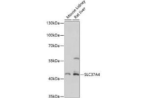 Western blot analysis of extracts of various cell lines, using SLC37 antibody (ABIN7270453) at 1:3000 dilution. (SLC37A4 抗体  (C-Term))