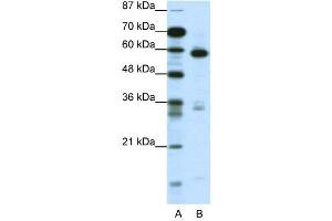 WB Suggested Anti-MBD1  Antibody Titration: 1. (MBD1 抗体  (C-Term))