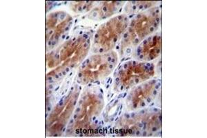SD9 Antibody (C-term) (ABIN651896 and ABIN2840442) immunohistochemistry analysis in formalin fixed and paraffin embedded human stomach tissue followed by peroxidase conjugation of the secondary antibody and DAB staining. (SAMD9 抗体  (C-Term))