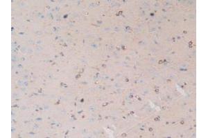 Figure. (MAP4 抗体  (AA 2-250))