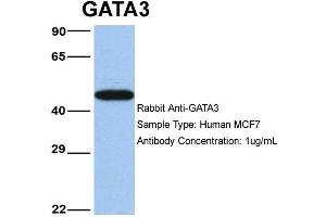 Western Blotting (WB) image for anti-GATA Binding Protein 3 (GATA3) (N-Term) antibody (ABIN2777460)