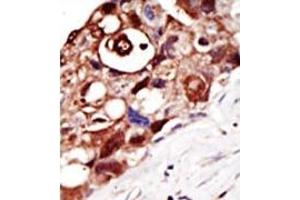 Image no. 1 for anti-GPI-anchor transamidase (GPI8) (N-Term) antibody (ABIN357725) (PIGK 抗体  (N-Term))