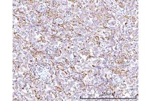 IHC analysis of RPN1 using anti-RPN1 antibody (ABIN7600447). (RPN1 抗体  (AA 196-495))