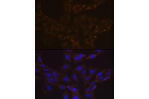 Immunofluorescence analysis of C6 cells using V Rabbit mAb (ABIN7271312) at dilution of 1:100 (40x lens).