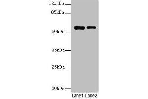 Western blot All lanes: WDR34 antibody at 1.
