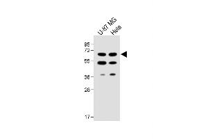 All lanes : Anti-UGT8 antibody (Center) at 1:1000 dilution Lane 1: U-87 MG whole cell lysate Lane 2: Hela whole cell lysate Lysates/proteins at 20 μg per lane. (UGT8 抗体  (AA 366-393))