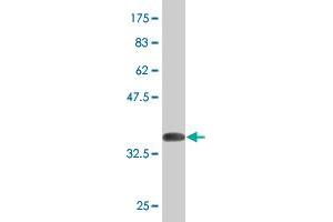 Western Blot detection against Immunogen (36. (Ketohexokinase 抗体  (AA 201-297))